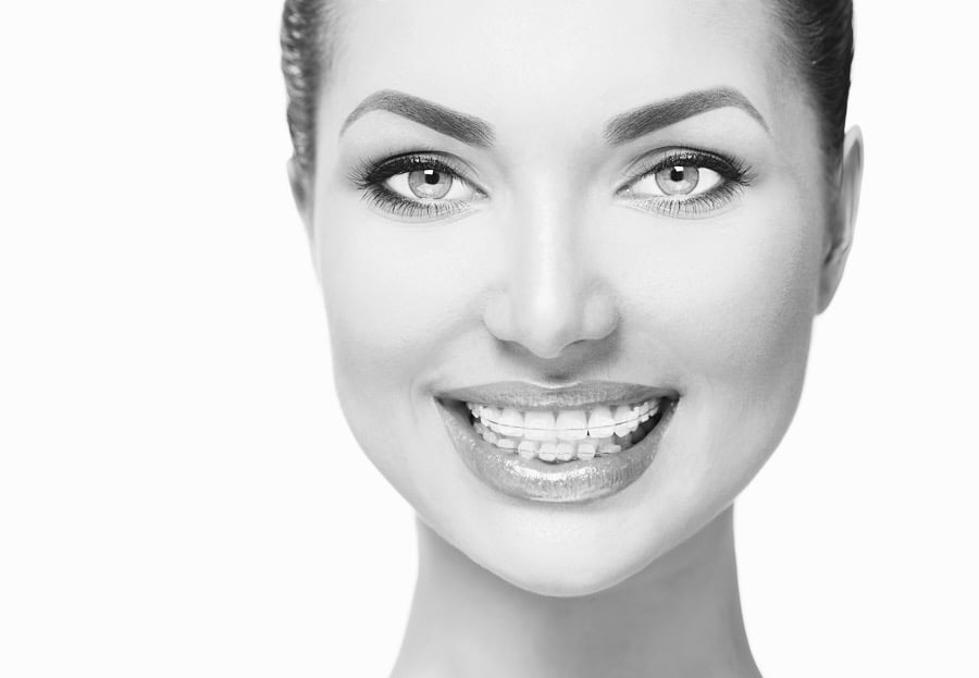 Ceramic braces - the benefits - Dental braces