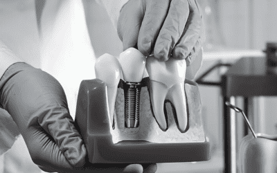 Bone Health For Successful Dental Implants